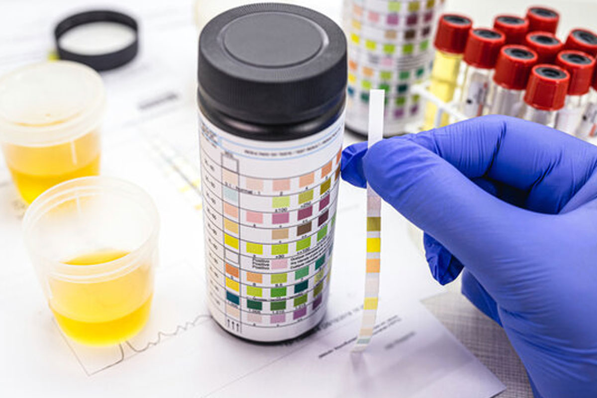 how to pass a drug test